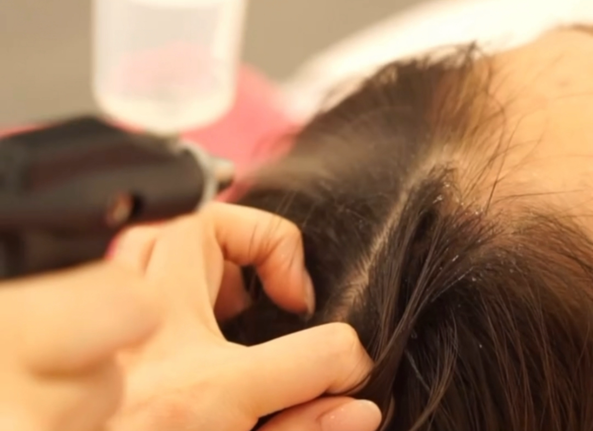 ④炭酸ガスで頭皮洗浄&血行促進