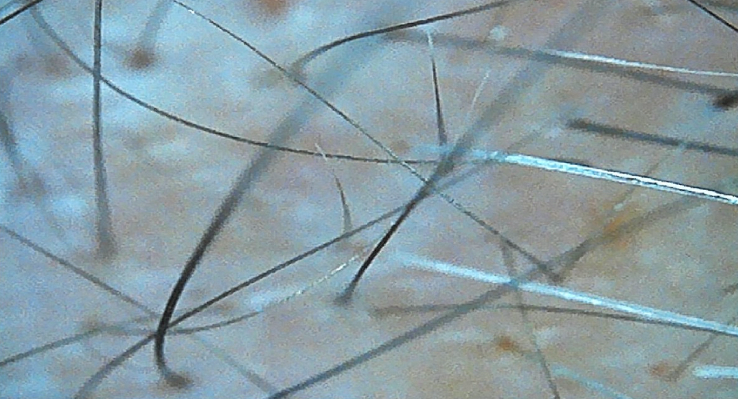 ⑧新毛チェック、ご自身の目で効果を実感。